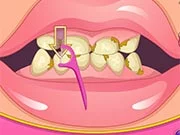 Bad Teeth Makeover Game - game